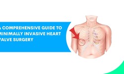 A Comprehensive Guide to Minimally Invasive Heart Valve Surgery