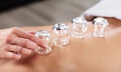 Exploring Cupping Therapy in Montreal: An Ancient Healing Practice