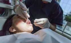 Convenient Tooth Removal in Abu Dhabi: Modern Dentistry