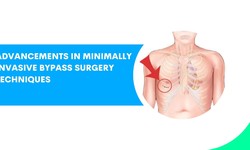 Advancements in Minimally Invasive Bypass Surgery Techniques