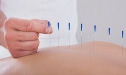 Harnessing the Power of Acupuncture and Herbal Medicine for Holistic Healing