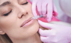Get Noticed with Lip Fillers in Abu Dhabi