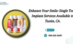 Enhance Your Smile: Single Tooth Implant Services Available in Tustin, CA.