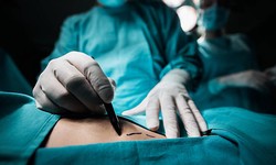 The Science Behind Liposuction Abu Dhabi: Revealed