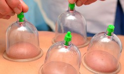 5 Things You Should Know About Hijama Treatment