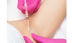 Navigating the Landscape of Injectable Fillers: What You Should Know