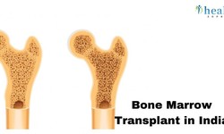 Restoring Your Health: The Benefits of Bone Marrow Transplantation