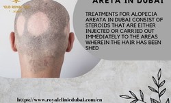 Preparing for the Procedure of Hair Transplant in Abu Dhabi