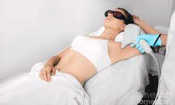 A Step-by-Step Guide to Laser Hair Removal Process