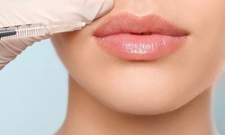 The Science Behind Lip Fillers: Exploring Different Types and Formulations