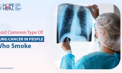 Most Common Type of Lung Cancer in People Who Smoke