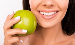 Transform Your Smile with a Makeover in Orlando, FL: Procedures, Benefits, and Considerations