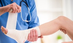 Exploring Surgical Solutions for Flatfoot by Foot Doctor in Pearland: What You Need to Know