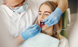Available Dental Crowns in Lake Mary FL
