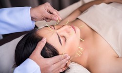 Can Acupuncture Alleviate Anxiety Symptoms Effectively?
