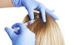 Bid Farewell to Hair Problems: PRP Therapy in Dubai