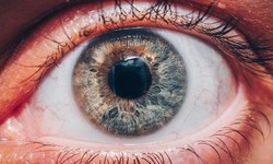 Clearing Vision: The Benefits of Cataract Surgery in Sherman
