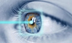 Essential things you should be aware of LASIK before the surgery