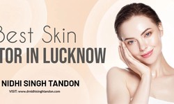 Skincare Tips from the Leading Dermatologist in Lucknow