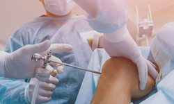 Exploring Robotic Knee Replacement Surgery