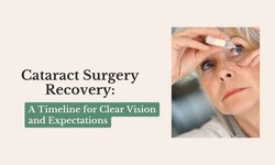 Cataract Surgery Recovery: A Timeline for Clear Vision and Expectations