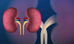 Understanding ICD 10 Codes for Urinary Tract Infections (UTI)