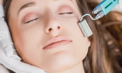 Step-by-Step Guide: What to Expect During a Micro RF Needling Procedure