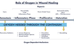 Healing Hope: Topical Wound Oxygen Therapy for Diabetic Leg Infections