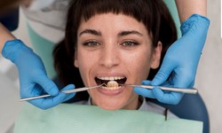 The Art of Brightening: How Teeth Whitening Dentists Transform Smiles