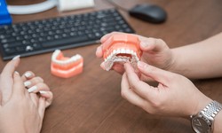 Transform Your Smile with the Best Orthodontist in Markham Offering Invisalign
