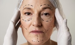 The Art of Facelift Surgery: Restoring Youthful Radiance with Dr. Ajinkya Patil in Pune
