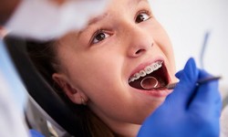 Demystifying Root Canal Treatment: What You Need to Know