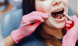 The Ultimate Guide to Composite Bonding: Transforming Your Smile