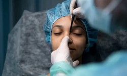 Best Rhinoplasty: Understanding the Surgery and Its Benefits