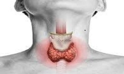 Expert Solutions for Thyroid Disorders: Your Guide to Finding the Best Hyperthyroidism and Hypothyroidism Doctor in Ghatkopar