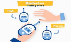 Managing High Blood Sugar: A Comprehensive Guide to Wellness