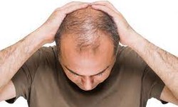 Dubai's Hair Loss Treatment Options: A Comprehensive Guide