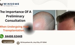 The Importance Of A Preliminary Consultation When Undergoing Hair Transplantation.