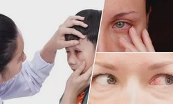 Protecting Eyes from Chemical Exposure with Eye Showers