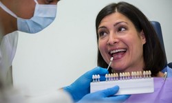 Understanding Dental Implants: The Ultimate Guide to Artificial Teeth in Leamington Spa