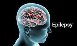 Innovative Approaches to Treating Epilepsy: Encouragering Progress and Prospective Paths