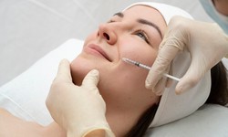 The Ultimate Guide to Micro-Needling Radio Frequency: Benefits, Techniques, and Results