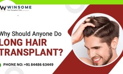 Why Should Anyone Do Long Hair Transplant Know More Details?