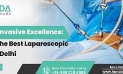 Laparoscopic Surgery in Delhi