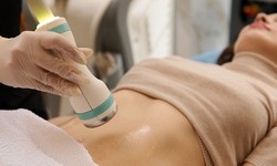 Reclaiming Confidence: The Science and Artistry of Liposuction Treatment
