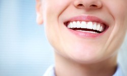 What to Consider Before Getting Dental Veneers?
