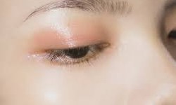 The Rise of Double Eyelid Surgery in Korea: A Cultural Perspective