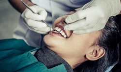 Implant Solutions: Discovering Dental Implants Near Me