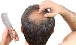 Enhance Your Confidence with DHI Hair Implantation in Dubai