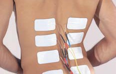 Electric Healing: Nerve Stimulation for Chronic Pain Relief